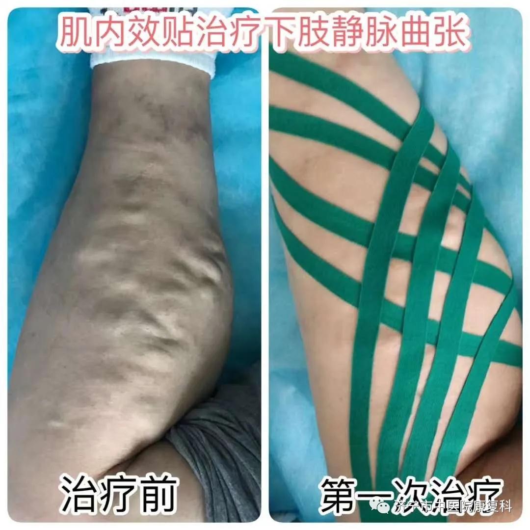 微信图片_20200327142607.jpg